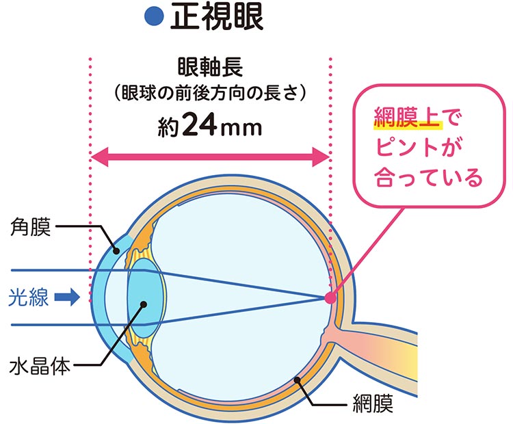 小児の近視について